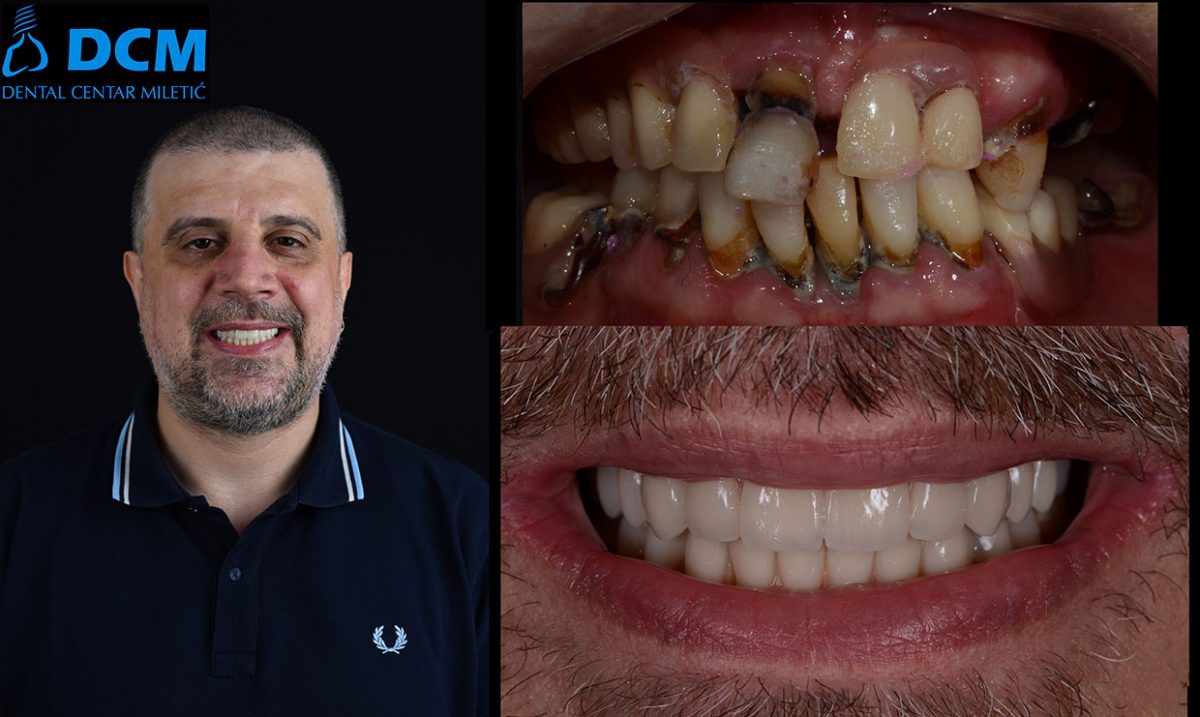 Dental Centar Miletic 8
