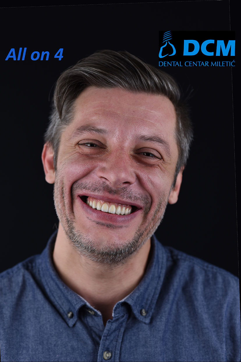 Dental Centar Miletic 9